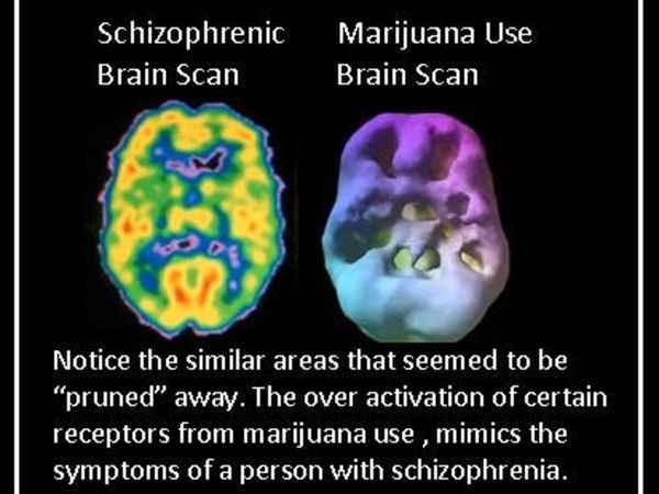 The Link Between Schizophrenia And Marijuana Cannabis Use