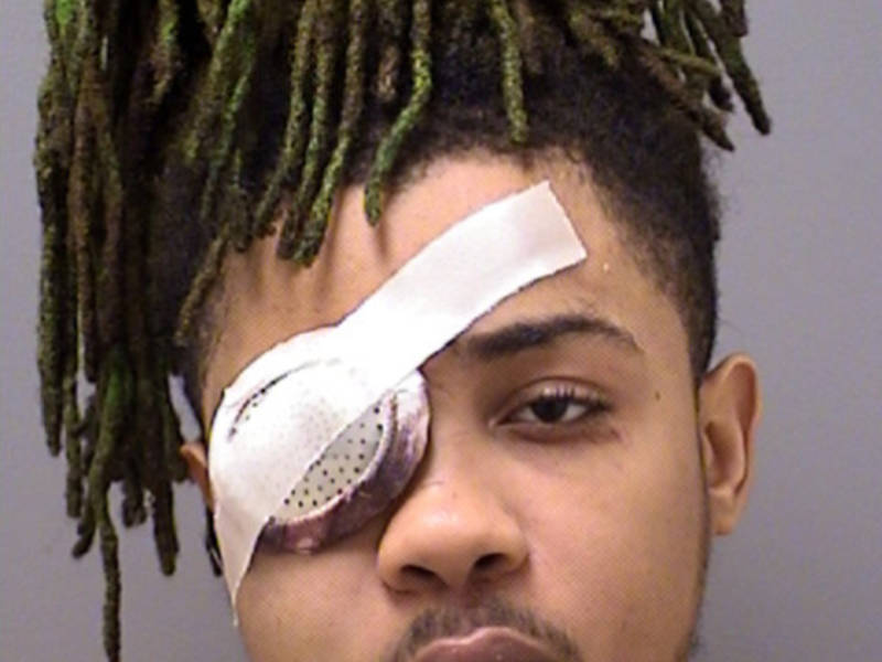 man shot in eye by homeowner charged with burglary