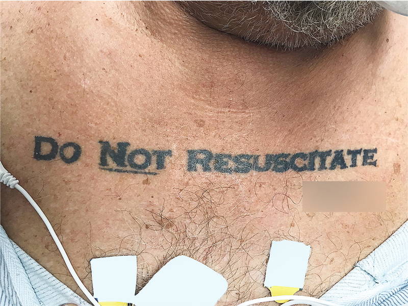 dnr tattoo creates ethical conundrum for miami hospital dnr tattoo creates ethical conundrum for miami hospital