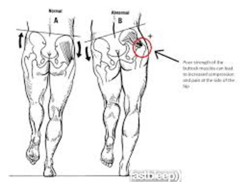 Hip Pain Overview Livermore, CA Patch
