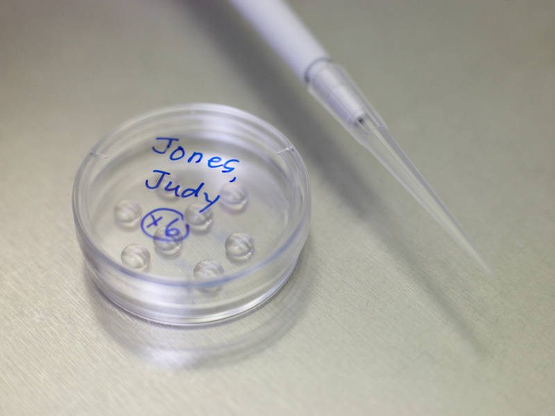 Frozen Eggs, Embryos Ruined At San Francisco Fertility Clinic San